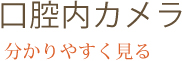 口腔内カメラ 分かりやすく見る